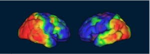 Two images of the human brain as represented by medical imaging. Different colours such as red, yellow, blue and green shade different areas of the brain in each image. It represents In-vivio visualisation of the brain and markers of disease.