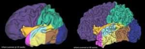 Neuroimaging showing a scan of an infant brain scanned at 30 weeks and at 40 weeks, showing the rapid development that happens during those weeks. The scans are on a black background with different colours representing different areas of the brain