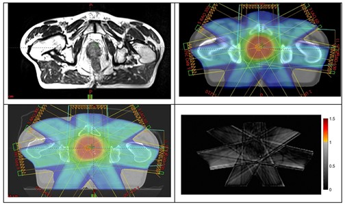 An MRI and 3 images produced by the CSIRO integrative software